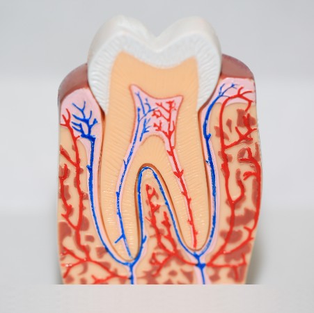 Root Canal Therapy in Winnipeg