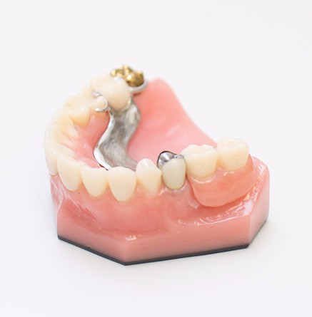 Dentures, Winnipeg Dentist